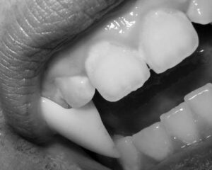 Image of vampire fangs