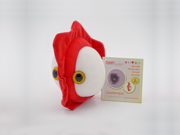 GIANTmicrobes® - Chicken pox