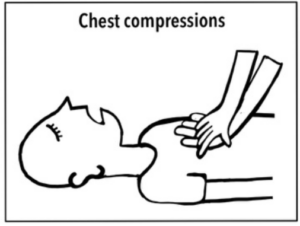 Image demonstrating chest compressions