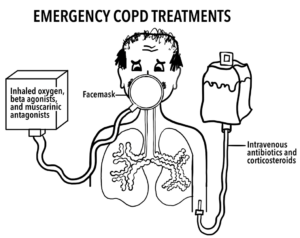 Image of emergency COPD treatments
