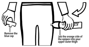 Image demonstrating an epipen injection