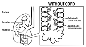 Image of healthy lung and healthy airway