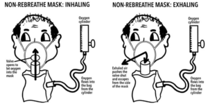 Image illustrating non-rebreathe mask