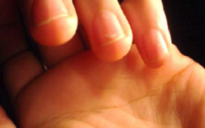 A Journey through the Skin