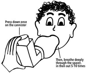 Image of a spacer inhaler
