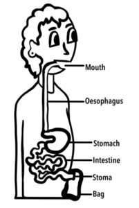 Image of stoma anatomy