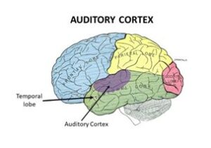 Image of the auditory cortex within brain