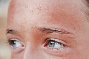 Image of sweaty woman's forehead