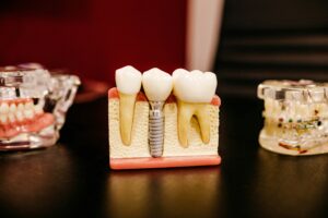Image of fake teeth showing fake tooth