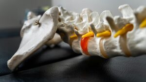 Image of a medical spine and pelvis model