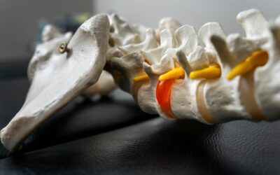 What is a lumbar puncture?