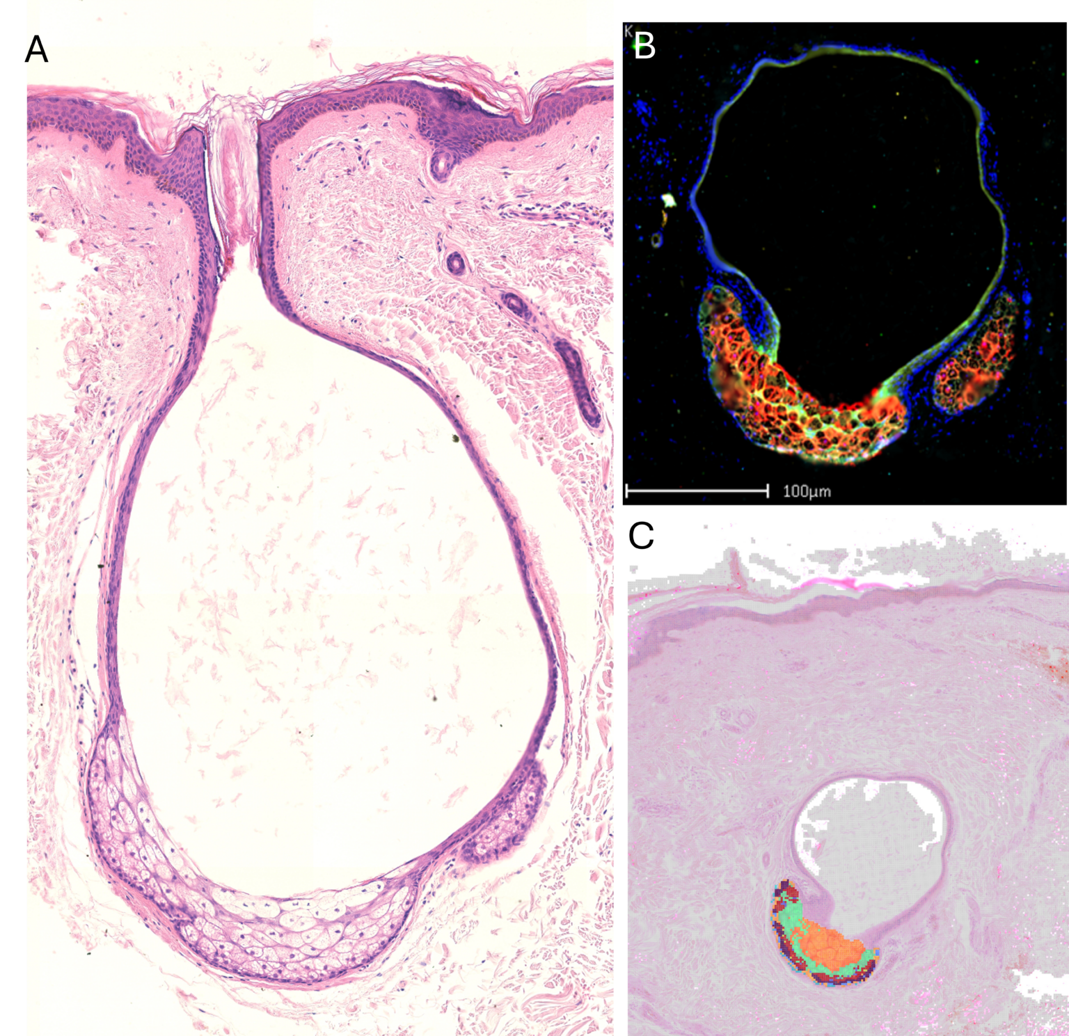 Shell Cyst Cell What's happening under the skin when a cyst forms? - Centre of the Cell
