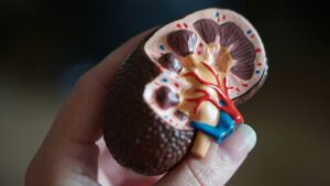 Image of a kidney anatomy model