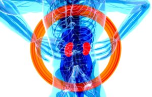 Illustration of kidneys in someone's back, radiating a problem