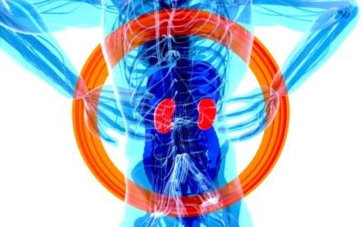 What is dialysis?