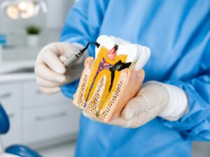 Image of a dentist showing a model of a damaged tooth