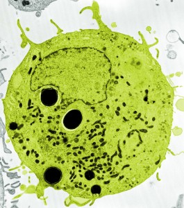 Picture of a macrophage