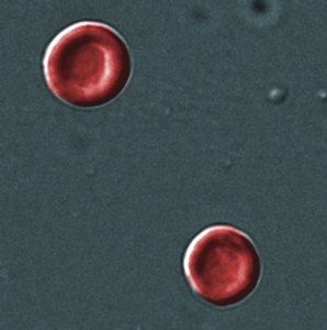 Picture of red blood cells